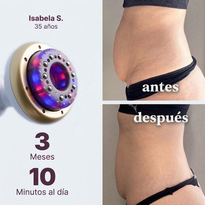 Antes y después de Isabela S. con Softivelle