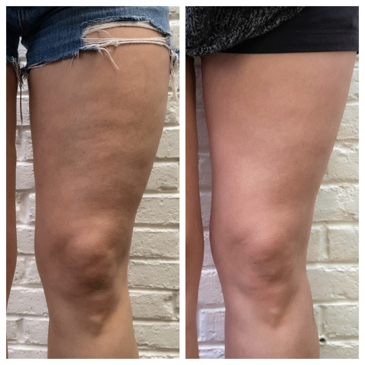 Antes y después de clienta con Softivelle