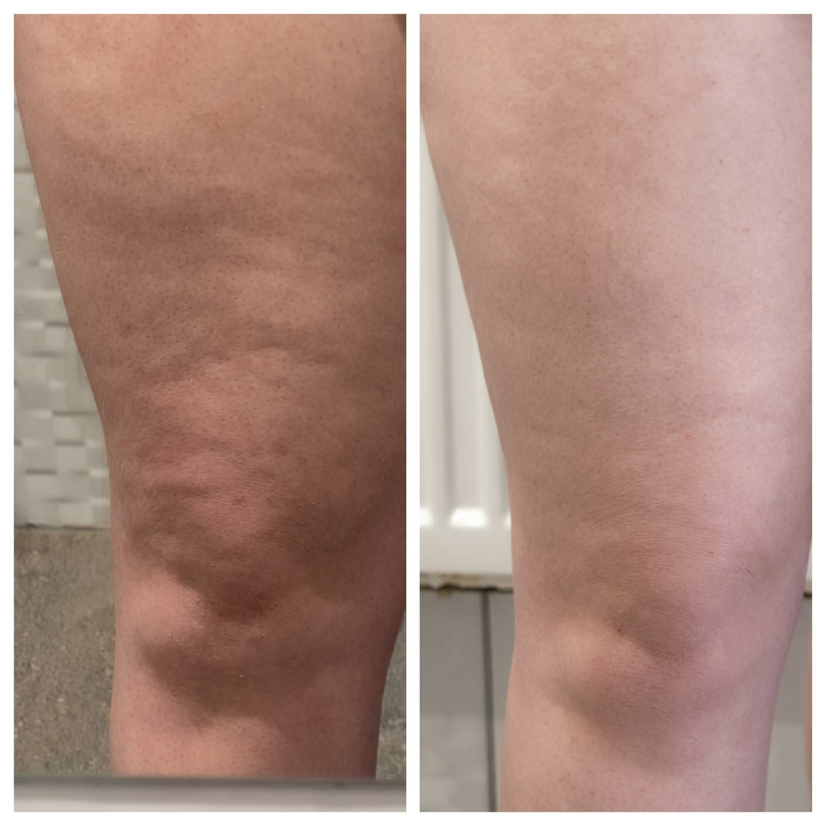 Antes y después de clienta con Softivelle